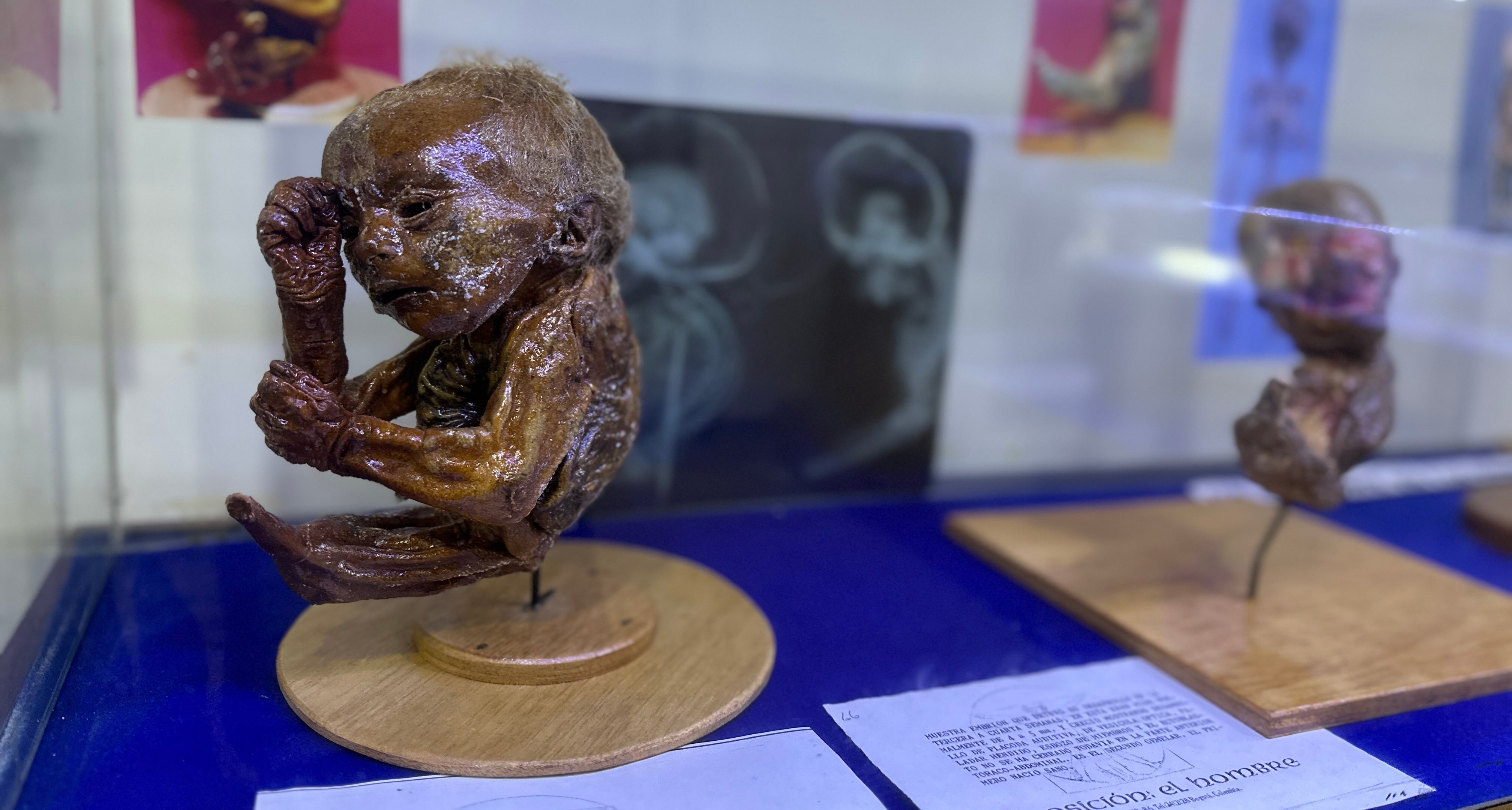 La historia del misterioso Museo del Ser Humano | Radiónica