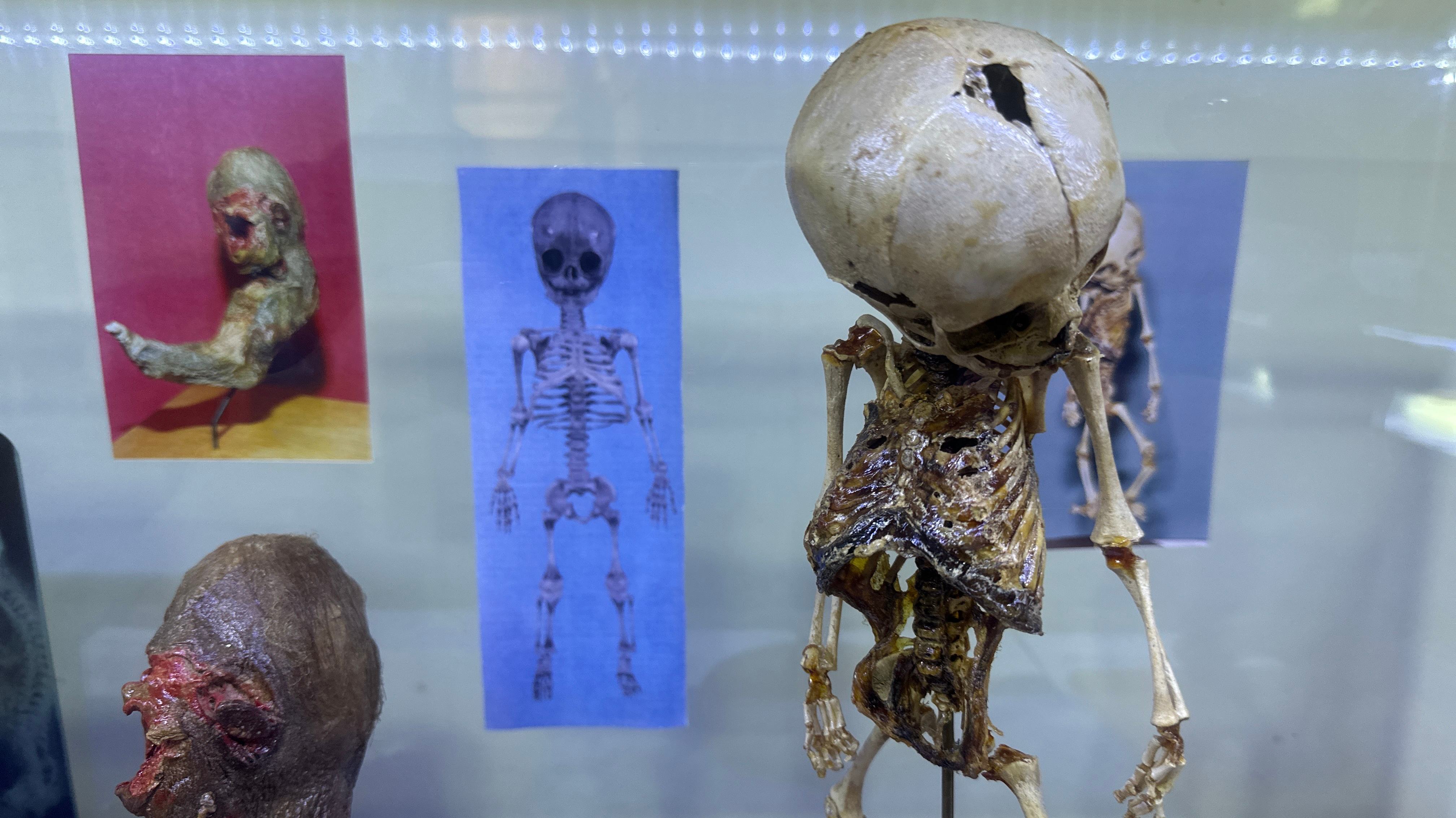 Museo del ser humano