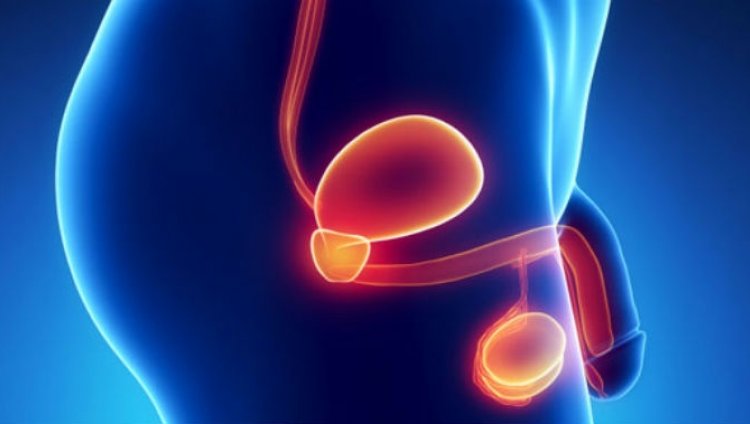 Lates: cáncer de próstata Lates: cáncer de próstata