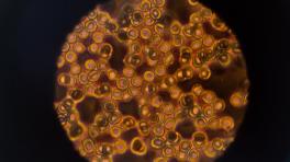 Microscopio /Imagen: Thisisengineering Raeng / Unsplash